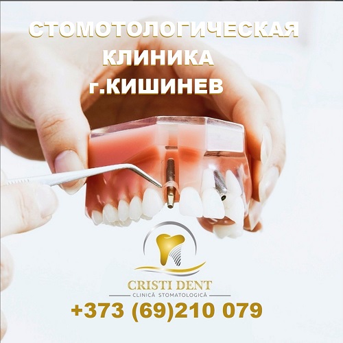 Расписание Стоматологической Клиники в Кишиневе — «Cristi Dent»