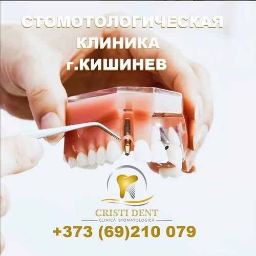 3D Томография в Кишиневе — Стоматологический Центр «Cristi Dent»