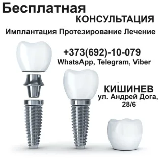 Качественная стомотология Кишинев - лечение зубов без боли